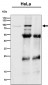 Anti-CSDE1 Rabbit Monoclonal Antibody